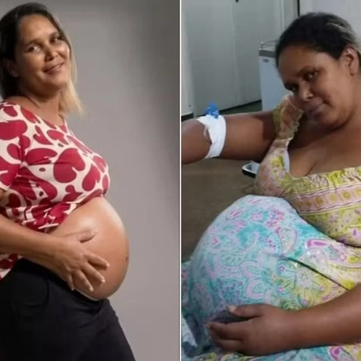 Morre 2º filho gêmeo de mulher que faleceu após ser liberada de hospital